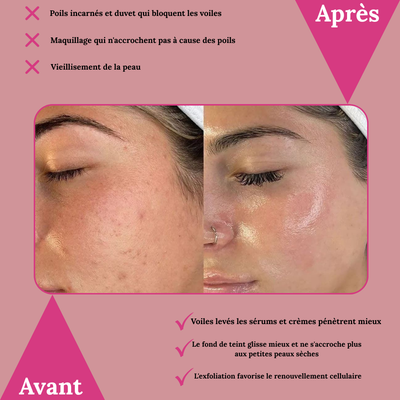 Kit Dermaplaning Complet – Peau Lisse & Éclat Instantané