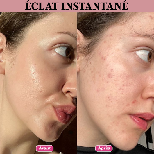 Kit Dermaplaning Complet – Peau Lisse & Éclat Instantané